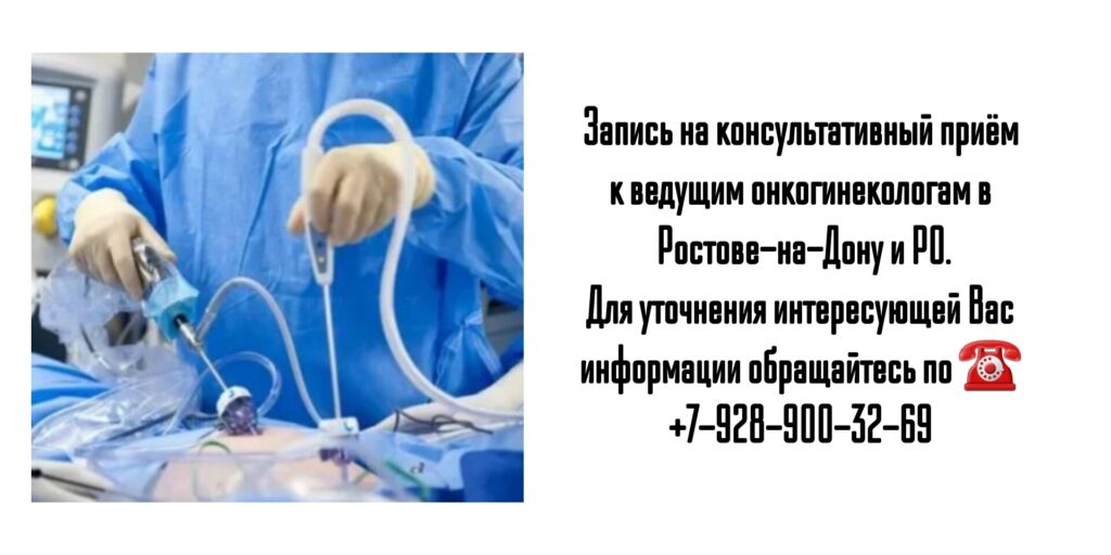 Ведущий онкологинеколог в Ростове-на-Дону- Ивановна Виктория Александровна
