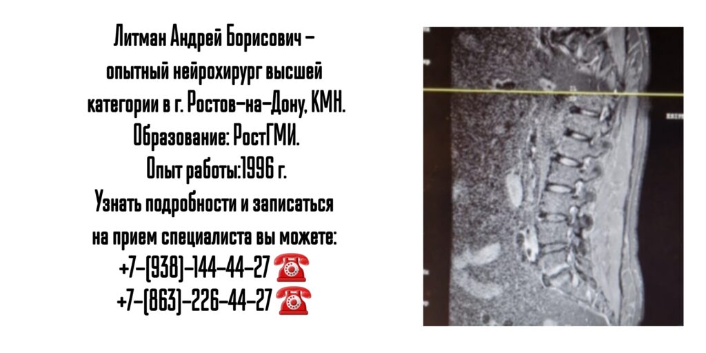 Опытный нейрохирург в Ростове-на-Дону- Литман Андрей Борисович