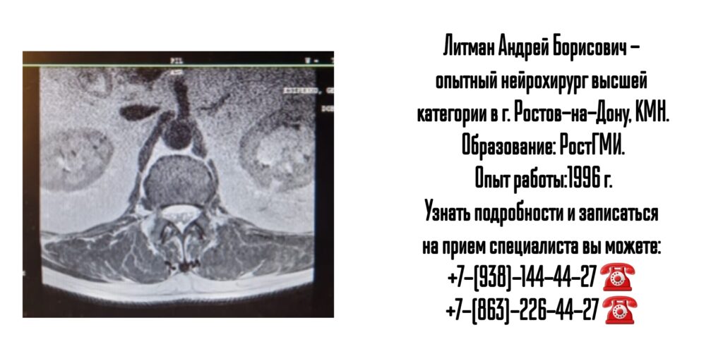 Опытный нейрохирург в Ростове-на-Дону- Литман Андрей Борисович