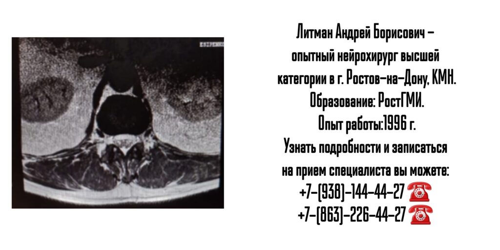 Опытный нейрохирург в Ростове-на-Дону- Литман Андрей Борисович