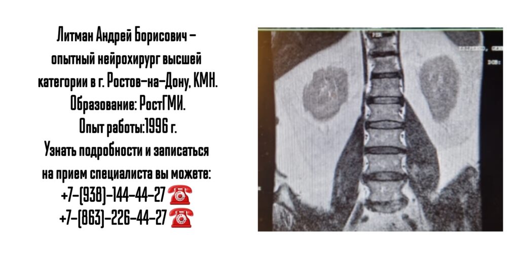 Опытный нейрохирург в Ростове-на-Дону- Литман Андрей Борисович