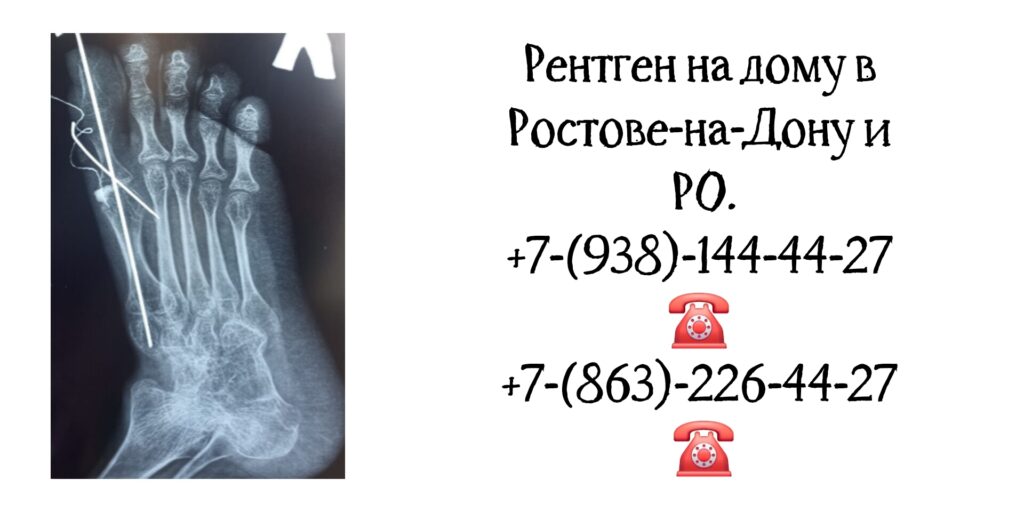 Рентген на дому в Ростове-на-Дону- забота о здоровье 