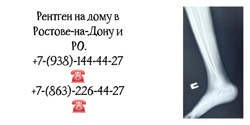 Рентген на дому в Ростове-на-Дону- забота о здоровье