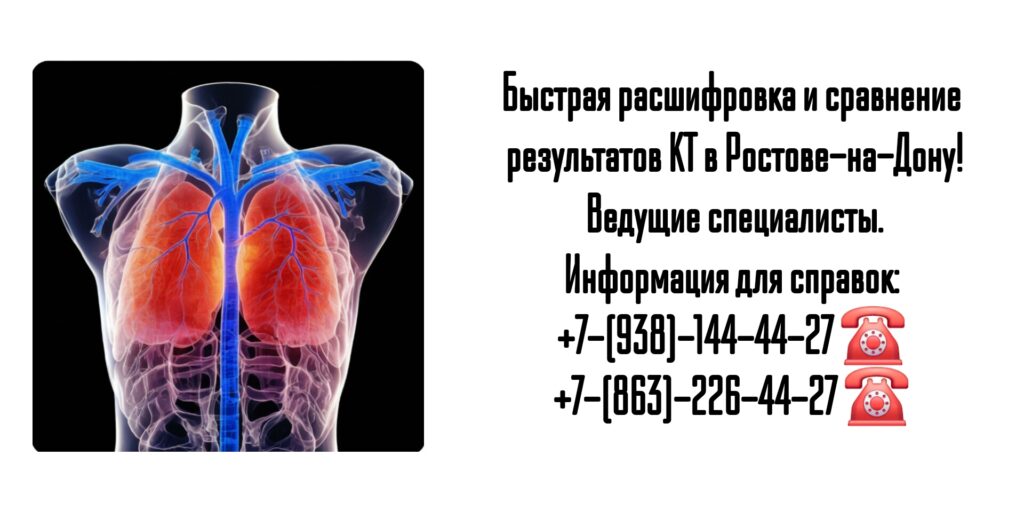 Расшифровка и сравнение результатов КТ в кратчайшие сроки в Ростове-на-Дону 