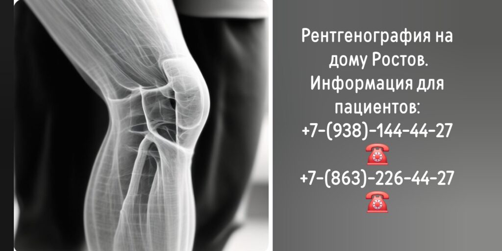 Заказ рентгена на дому Ростов