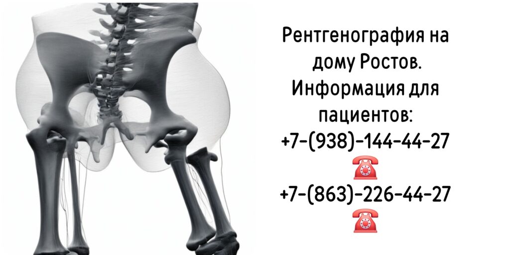 Заказ рентгена на дому Ростов