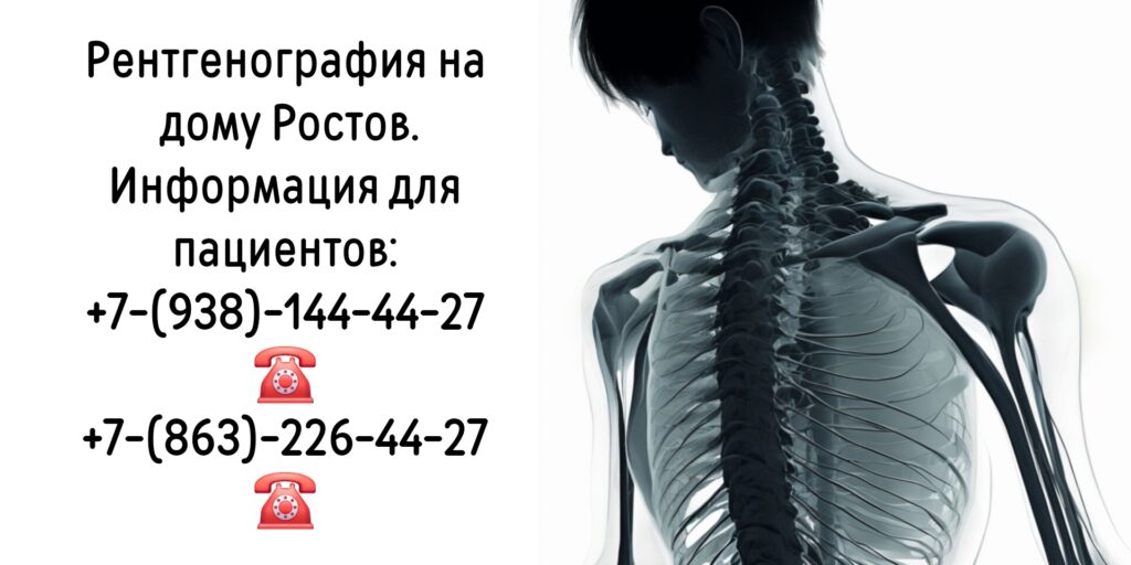 Заказ рентгена на дому Ростов