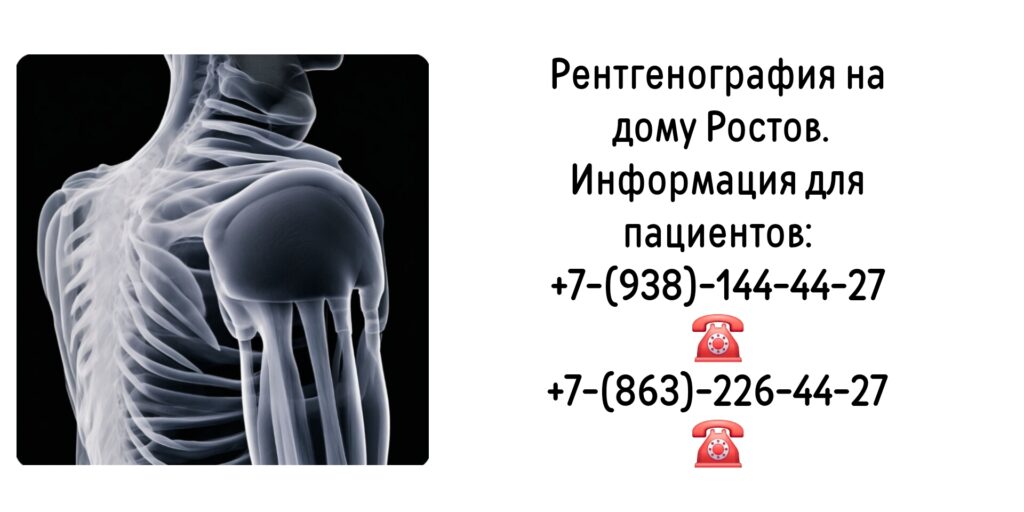 Заказ рентгена на дому Ростов