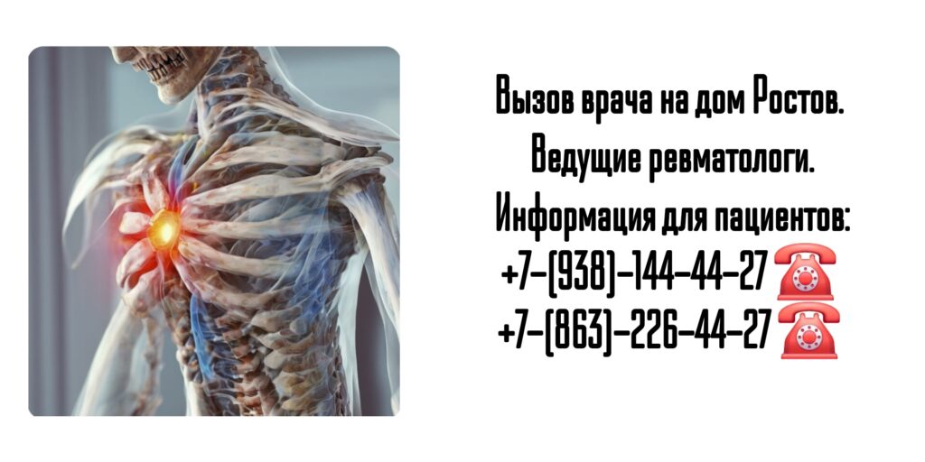Ревматолог на дом Ростов