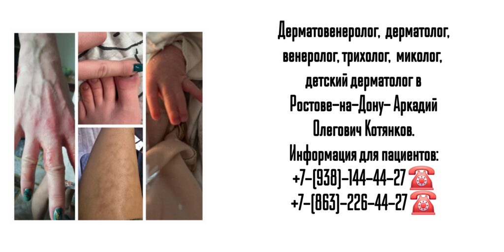 Запись на прием к дерматологу - Ростов-на-Дону Котянков А.О.