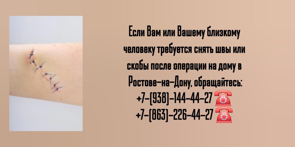 Снять швы на дому после операции- Ростов-на-Дону 