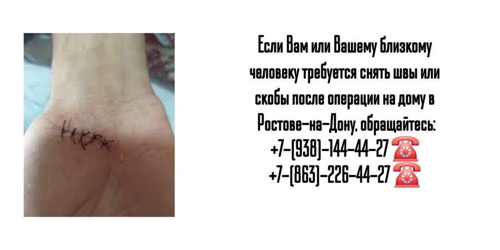 Снять швы на дому после операции- Ростов-на-Дону 