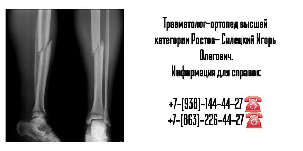 Силецкий Игорь Олегович- травматолог хирург Ростов-на-Дону
