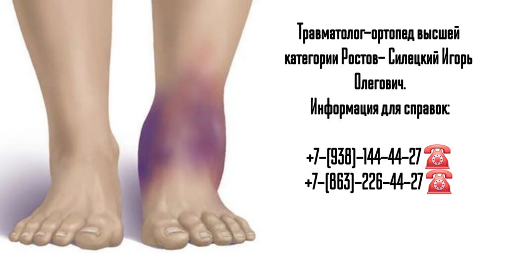 Силецкий Игорь Олегович- травматолог хирург Ростов-на-Дону