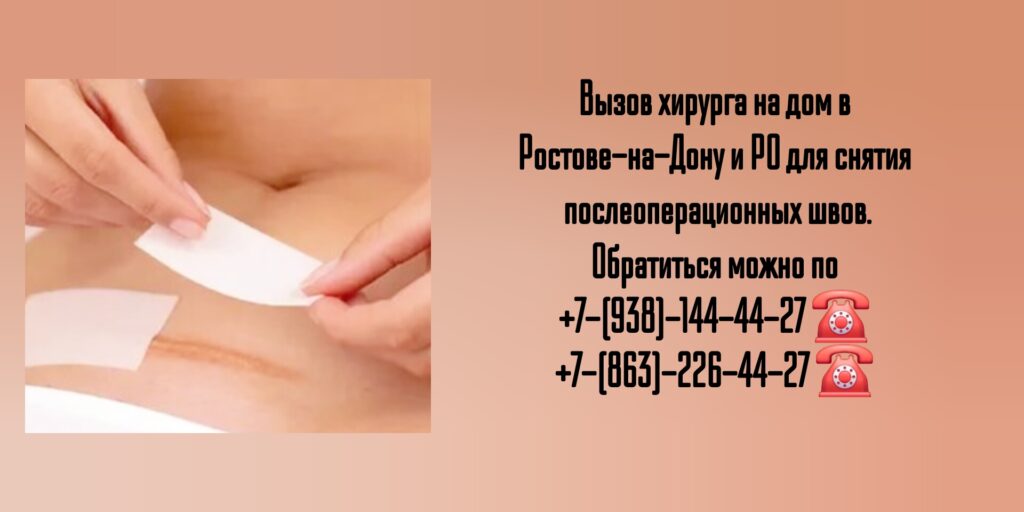 Снятие послеоперационных швов на дому Ростов 