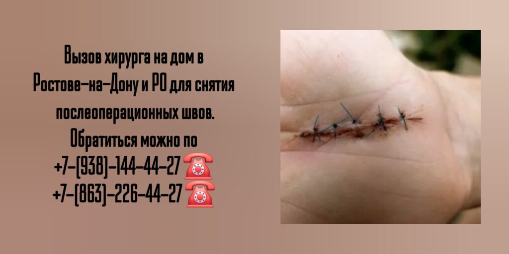 Снятие послеоперационных швов на дому Ростов 