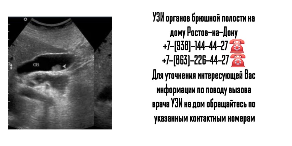 УЗИ органов брюшной полости на дому Ростов-на-Дону 