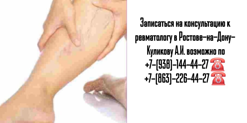 Запись на прием к ревматологу в Ростове-на-Дону- Куликов Алексей Игоревич 