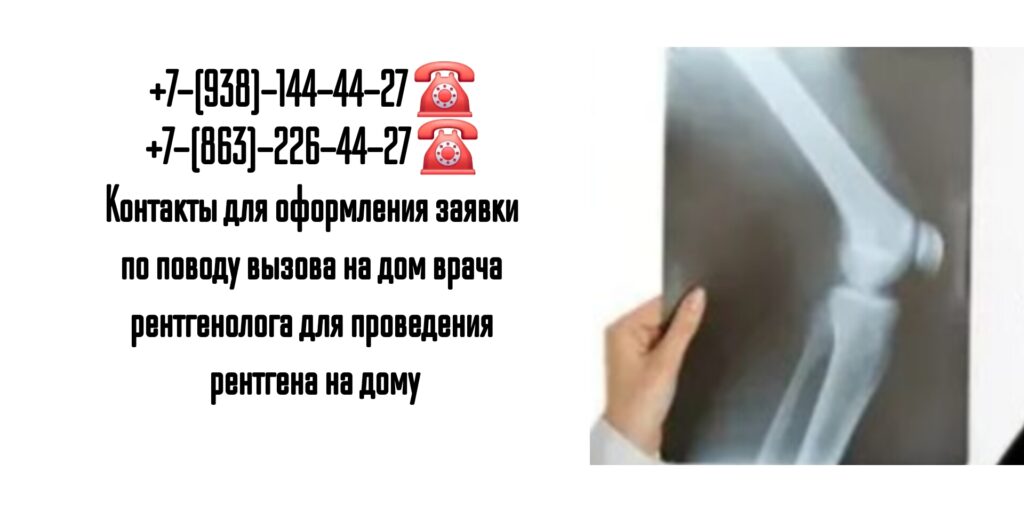 Рентген на дом Ростов-на-Дону