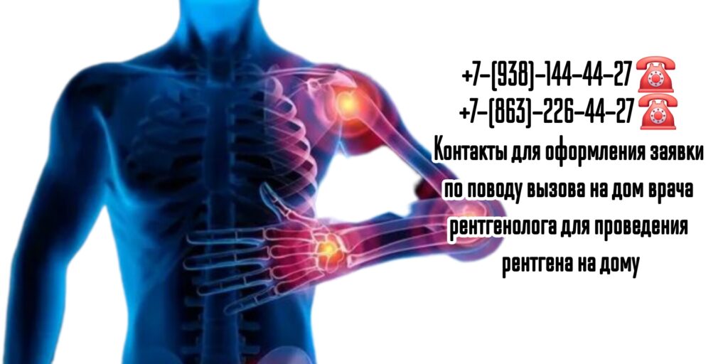 Рентген на дом Ростов-на-Дону