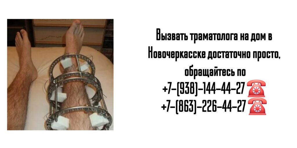 Новочеркасск травматолог на дом - Зубаха Никита Борисович