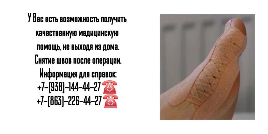 Снятие послеоперационных швов на дому в Ростове-на-Дону