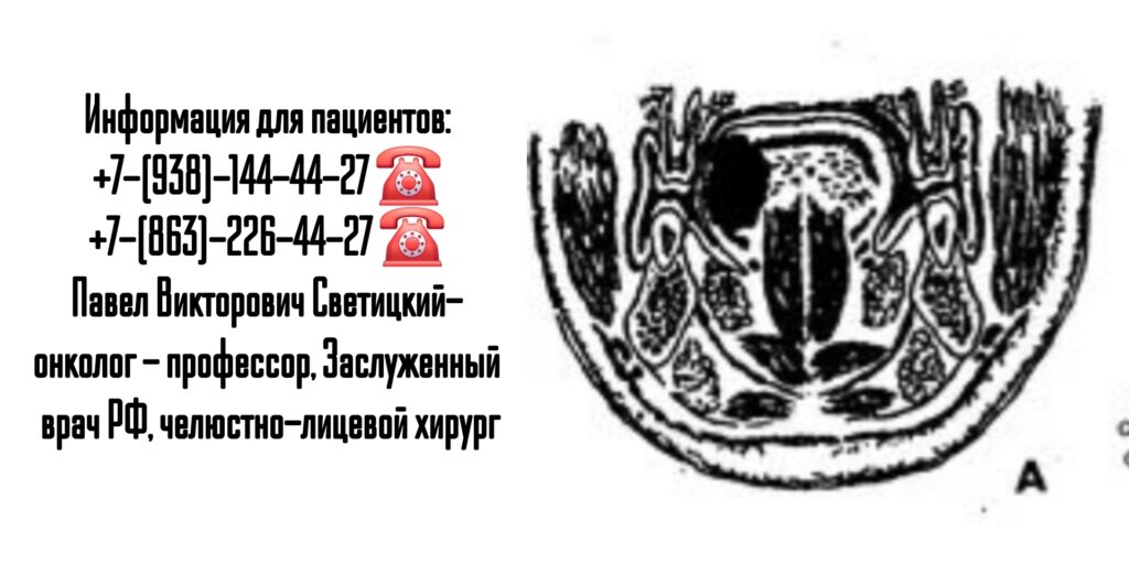 Светицкий Павел Викторович- онколог - челюстно-лицевой хирург Ростов-на-Дону 