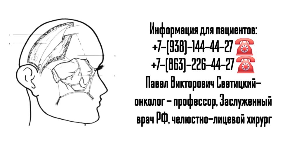 Светицкий Павел Викторович- онколог - челюстно-лицевой хирург Ростов-на-Дону 