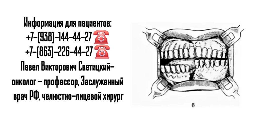 Светицкий Павел Викторович- онколог - челюстно-лицевой хирург Ростов-на-Дону 
