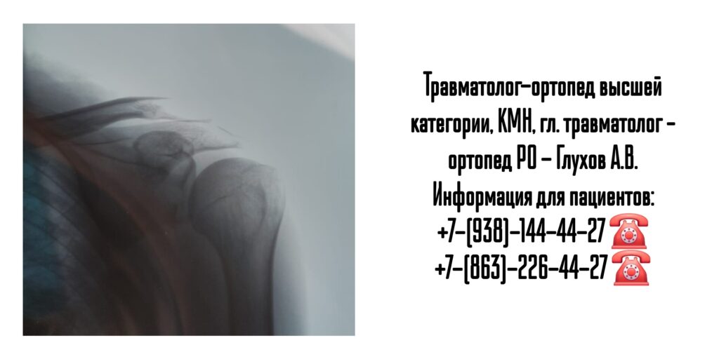 Прием травматолога Ростов - Глухов Алексей Вячеславович 