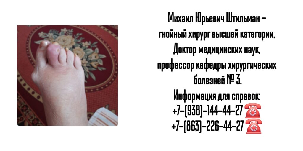 Штильман Михаил Юрьевич - Ростов гнойный хирург 