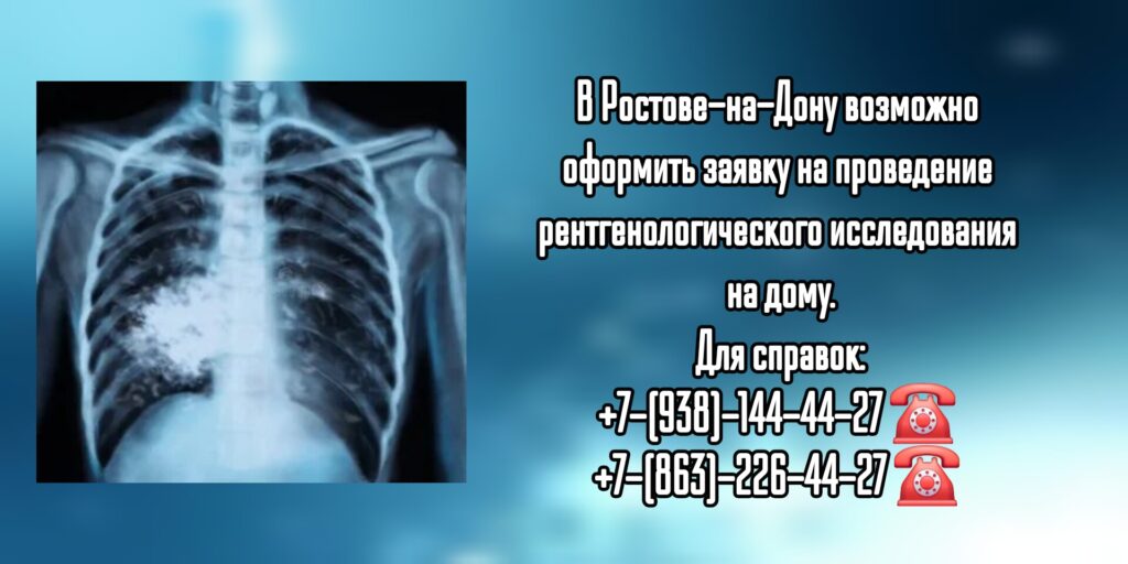 Рентген на дому - Выездной Рентген в Ростове-на-Дону 