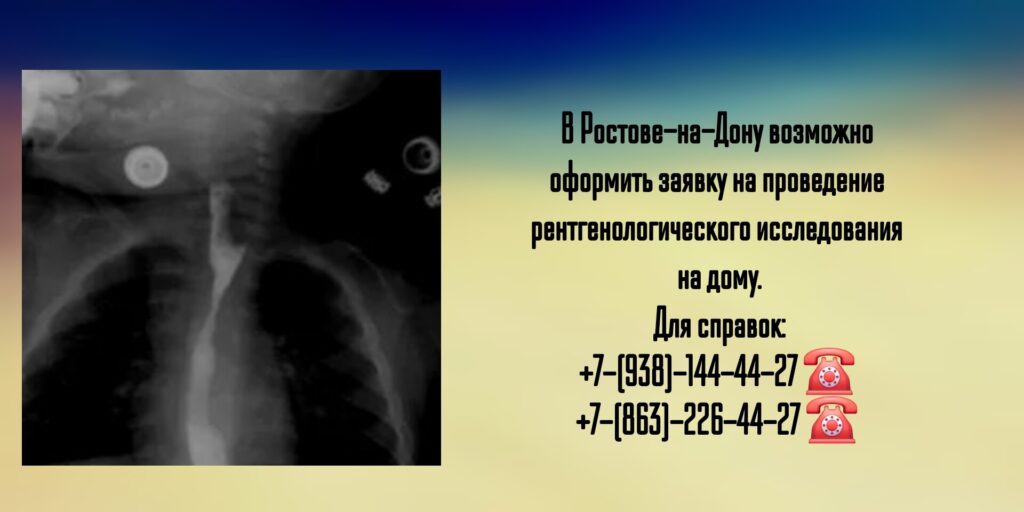 Рентген на дому - Выездной Рентген в Ростове-на-Дону 