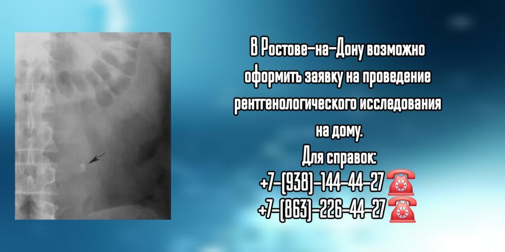 Рентген на дому - Выездной Рентген в Ростове-на-Дону 