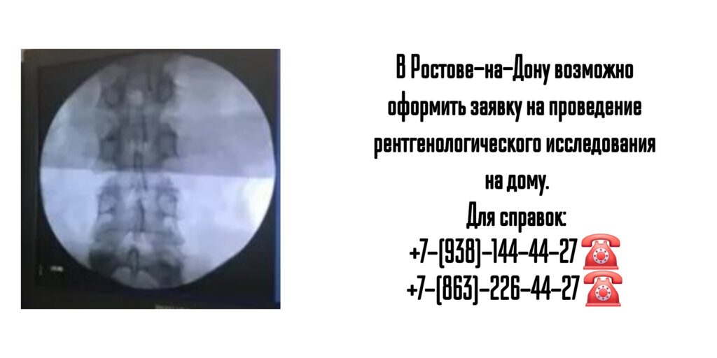 Рентген на дому - Выездной Рентген в Ростове-на-Дону 