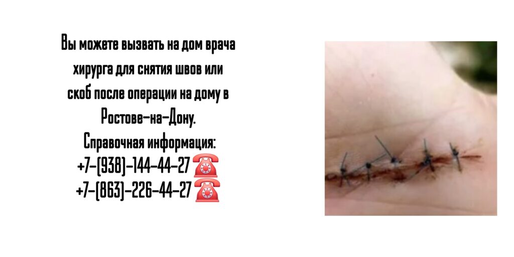 Ростов -на-Дону - снятие швов или скоб после операции 