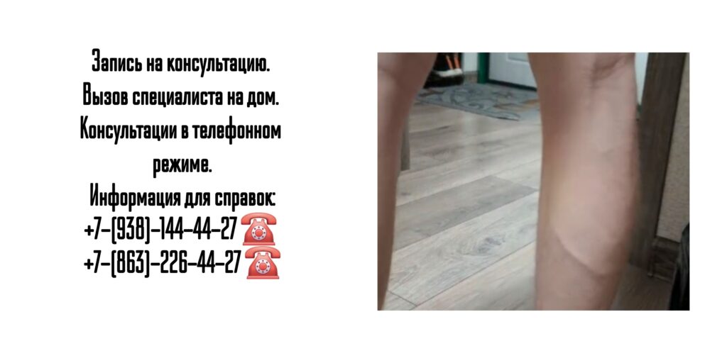 Ведущие сосудистые хирурги Ростова-на-Дону и РО