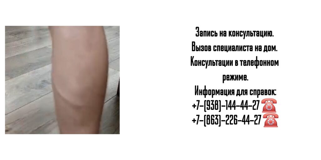 Ведущие сосудистые хирурги Ростова-на-Дону и РО