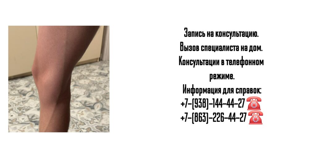 Ведущие сосудистые хирурги Ростова-на-Дону и РО