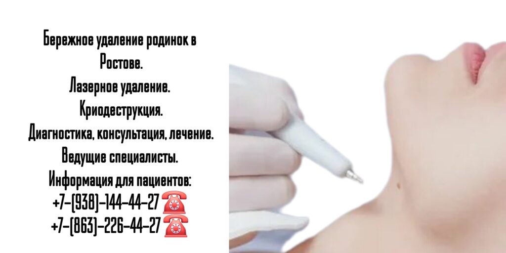 Криодеструкция в Ростове-на-Дону 