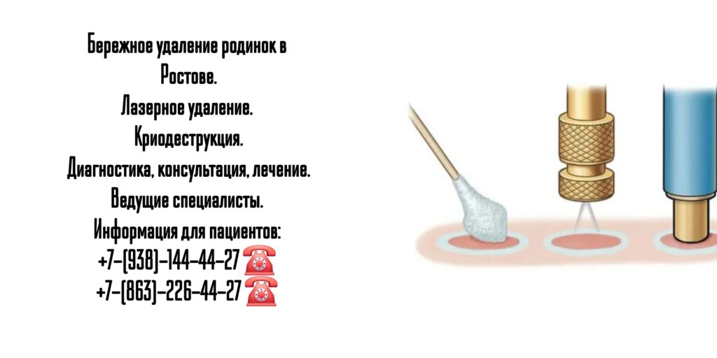 Криодеструкция в Ростове-на-Дону 