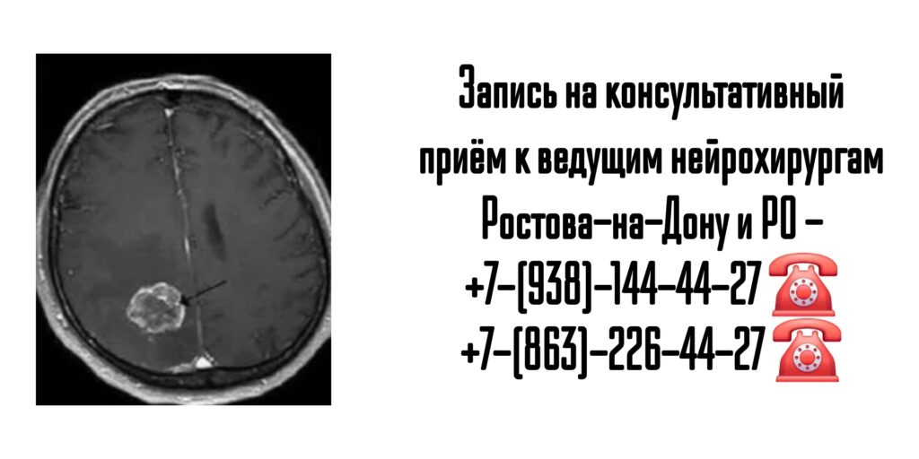 Молдованов Владимир Архипович - ведущий нейрохирург Ростова-на-Дону и РО 