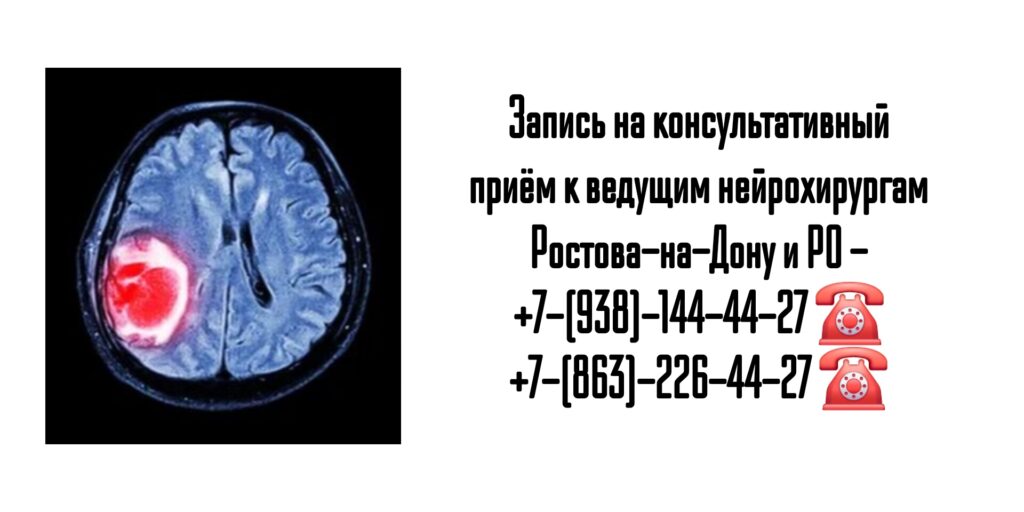 Молдованов Владимир Архипович - ведущий нейрохирург Ростова-на-Дону и РО 