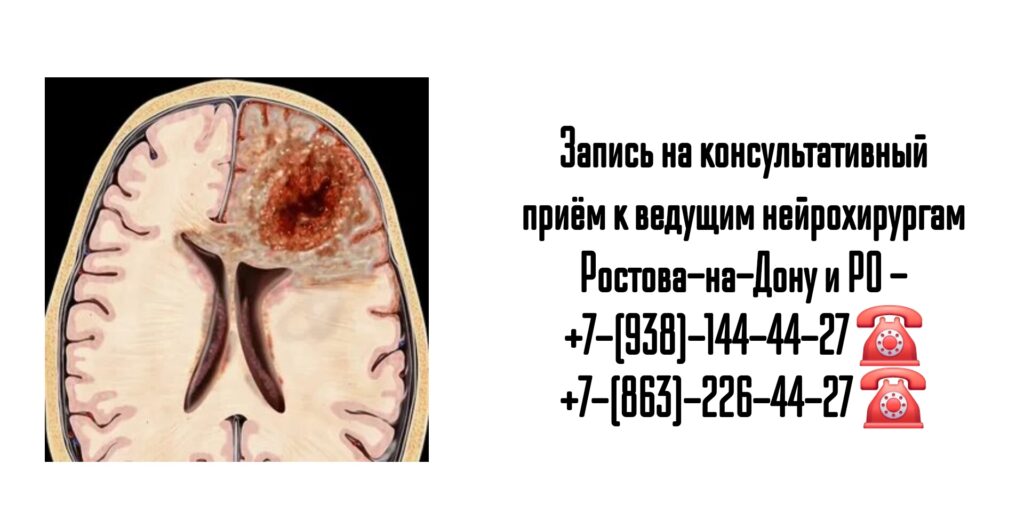 Молдованов Владимир Архипович - ведущий нейрохирург Ростова-на-Дону и РО 