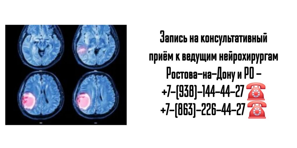 Молдованов Владимир Архипович - ведущий нейрохирург Ростова-на-Дону и РО 