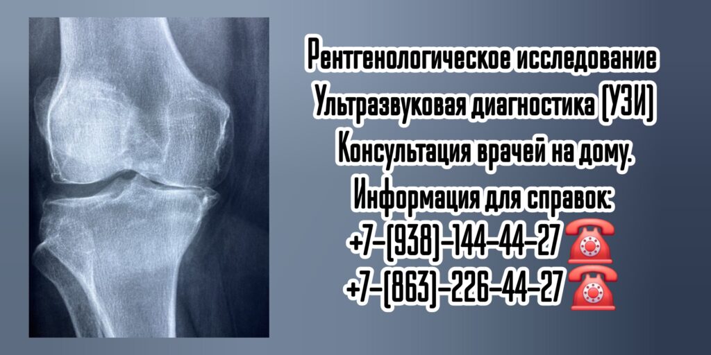 Рентген на дом в Ростове-на-Дону