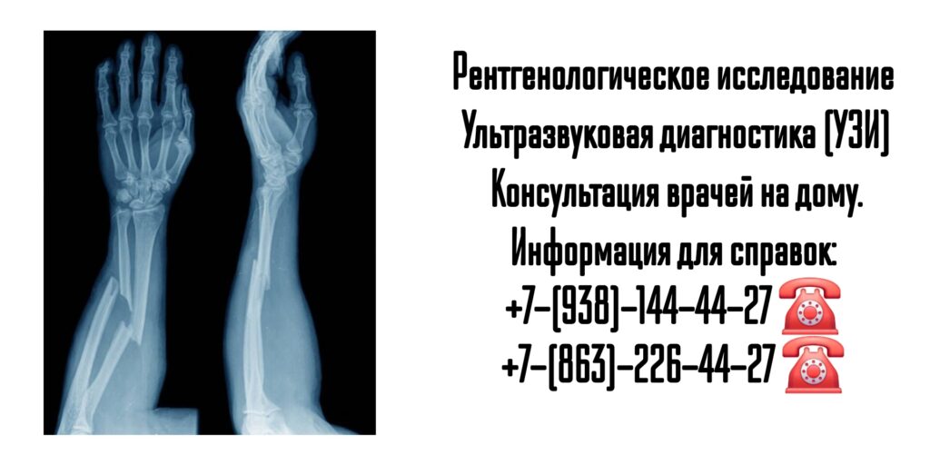 Рентген на дом в Ростове-на-Дону