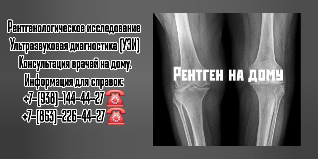 Рентген на дом в Ростове-на-Дону