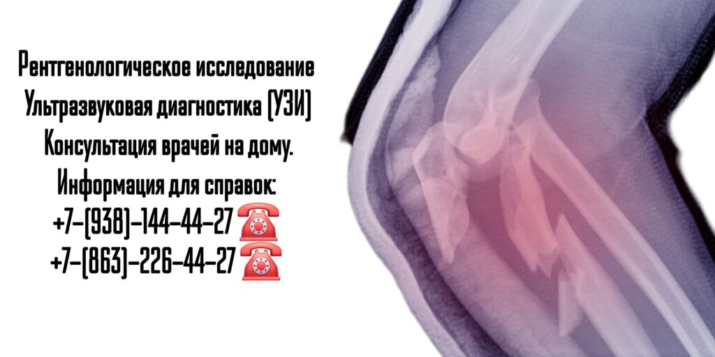 Рентген на дом в Ростове-на-Дону