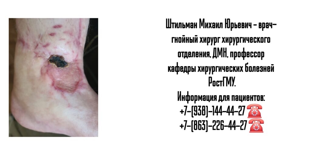 Штильман Михаил Юрьевич- профессор- гнойный хирург Ростов